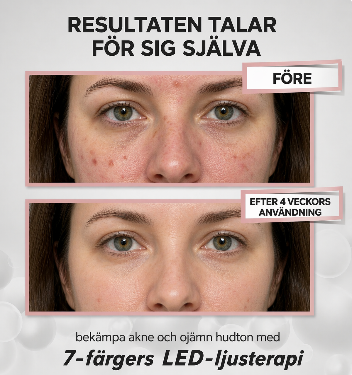 GlowNordic PRO LED-mask: 7-färgers ljusterapi GlowNordic